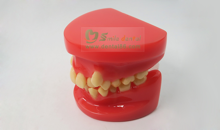 Orthodontic Model